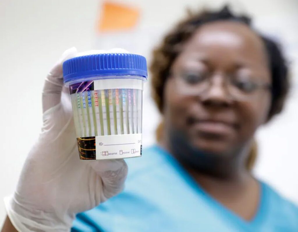 Woman wearing a medical glove and holding a sample cup